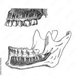 chirurgie cervico-maxillo-faciale